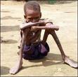 Starvation